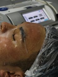 -长沙雅美医疗美容医院