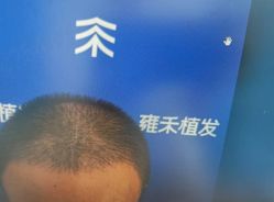 -雍禾植发全国连锁