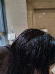 -碧莲盛·不剃发植发