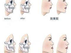 -团圆口腔·种植中心(锦江院区)