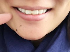 -清华大学玉泉医院