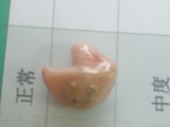 -自然之声助听器·呼吸机(保定清苑店)