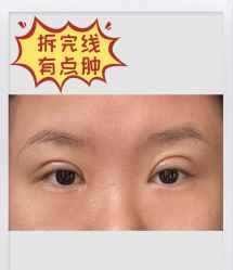 -素美医疗美容·西南眼鼻整形·修复基地