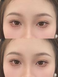 点击看大图 -张小野·专业半永久纹眉