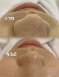 -LUNA皮相美·骨相美高级美感