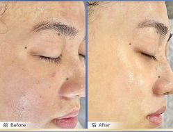 -美肤盾祛痘·问题肌头疗管理中心