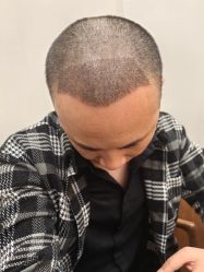 -碧莲盛·脱发养发中心