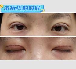 -素美医疗美容·西南眼鼻整形·修复基地