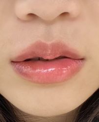 -深圳鹏爱秀琪医疗美容医院