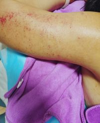 -清媚减肥瘦身纤体