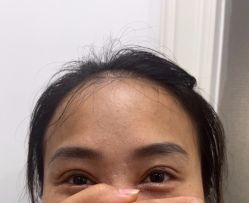 -万州华美紫馨整形美容医院