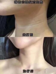 -上海漾颜医疗美容