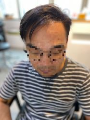 -髻尚坊增发补发织发假发定制