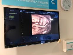 -杭州贝瑞斯美华妇儿医院·早孕·产检·儿科