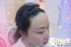 -大麦微针植发全国连锁