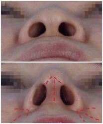 -南宁华美医疗美容医院