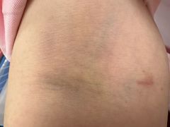 -复旦大学附属华山医院(总院)