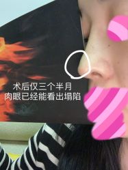-成都西区医院整形美容