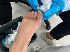 -世龙世家灰指甲·甲沟炎·跖疣护理·修脚(东江湾路店)