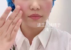 体验后-大连美天医疗美容医院