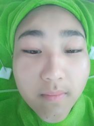-荟草堂专业痘肌皮肤管理