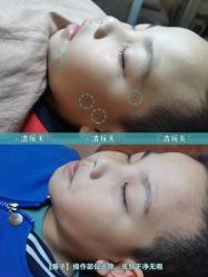-清疣美疣·痣·斑净肤中心