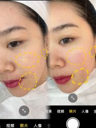 -北京英煌医疗美容·轻颜六区注射修复