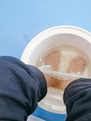 -足太医扦脚·灰指甲·嵌甲