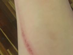 -奔马滚轴溜冰场