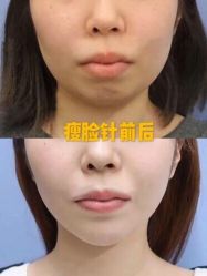 -Yestar宁波艺星整形医院
