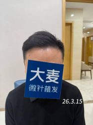 -大麦微针植发丨全国连锁