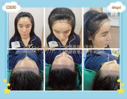 -熙朵美学植发·连锁品牌