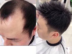 -发饰美男士增发补发假发定制店