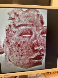 -苑苑vbeauty科技美容SPA