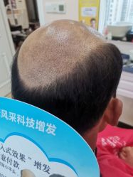 -唐风采假发补发定制