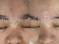 -蕾特恩专业祛痘·皮肤管理