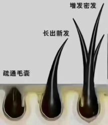-诗碧曼养发
