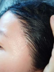 体验后-杭州米兰柏羽医疗美容医院