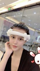 点击看大图 -大麦微针植发丨全国连锁