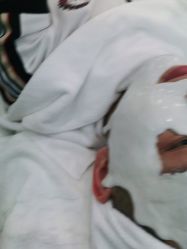 -悟空祛痘·诺奖技术专业店