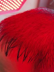 -碧莲盛·不剃发植发