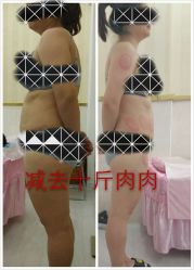 -摩瘦纤体订制减肥