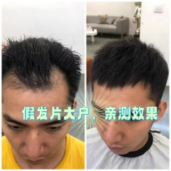 -唐风采假发补发定制