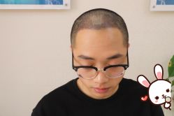 -大麦微针植发丨全国连锁