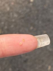 -万州华美紫馨整形美容医院