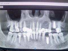 -齐玉齿科JADENTAL