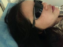 -肥三针腧穴瘦身馆