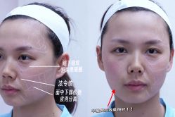 -Yestar重庆艺星医疗美容医院