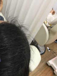 -菩叶脱发白发中心