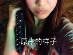 原来没开眼睛时候的样子-上海华安整形外科门诊部